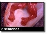 Fotografía de aborto - 7 semanas