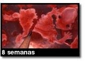 Fotografía de aborto - 8 semanas